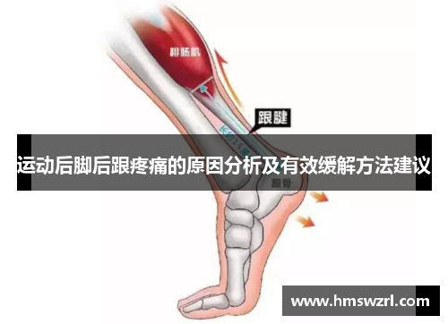 运动后脚后跟疼痛的原因分析及有效缓解方法建议